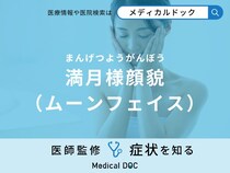 「満月様顔貌（ムーンフェイス）」を発症する原因はご存知ですか？対処法も医師が解説！