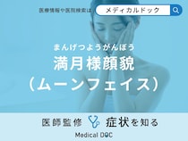 「満月様顔貌（ムーンフェイス）」を発症する原因はご存知ですか？対処法も医師が解説！