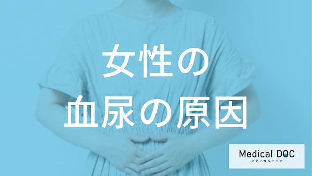 何を飲むと「血尿」の再発を抑えやすい?女性に多い膀胱炎との”予防法”を医師が解説