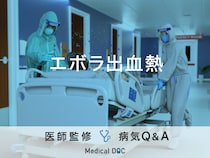 「エボラ出血熱」に感染すると現れる症状・致死率はご存知ですか？医師が監修！