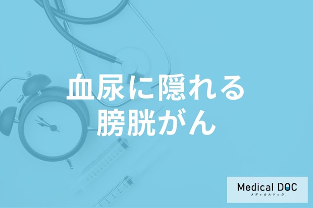 血尿に隠れる「膀胱がん」の可能性… 考えられる疾患や診断方法を医師に聞く