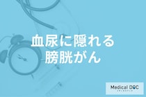 血尿に隠れる「膀胱がん」の可能性… 考えられる疾患や診断方法を医師に聞く