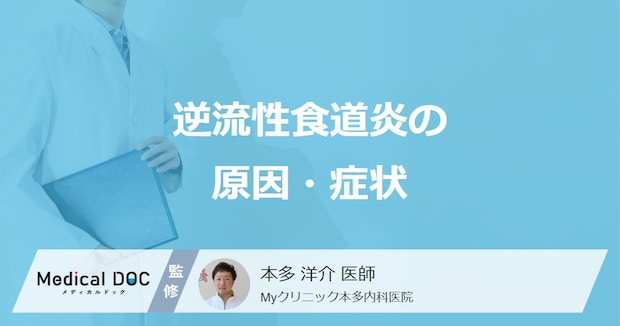 「逆流性食道炎の原因・症状」はご存知ですか？【医師監修】
