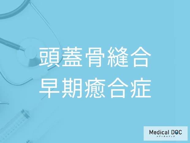 赤ちゃんの頭の形が歪む原因をご存じですか？ 「頭蓋骨縫合早期癒合症」の特徴を医師が解説