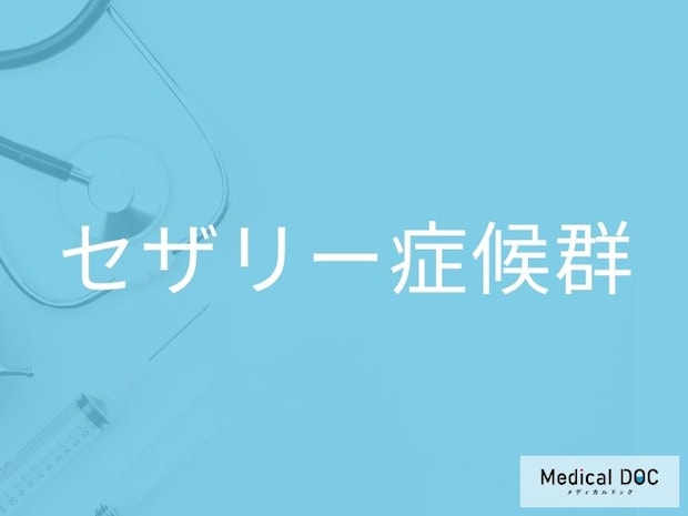 その肌荒れ、実は“皮膚がん”かも？ 「セザリー症候群」の初期症状と見分け方を医師が解説