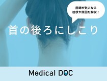 「首の後ろにしこり」ができる原因はご存知ですか？医師が徹底解説！