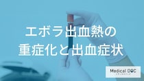 『エボラ出血熱』の正体は「出血」ではない？ “重症”の真実を医師が解説