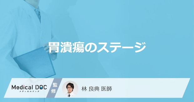 「胃潰瘍のステージ別の症状」はご存知ですか?治療法についても解説!【医師監修】