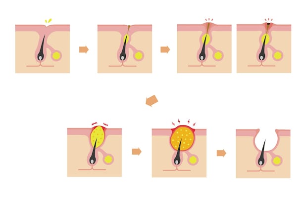 早めにおこなうことの意義は？ 治療が遅くなるとどうなる？