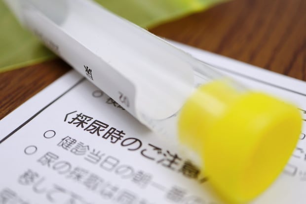 検査と治療の進め方を医師が解説！