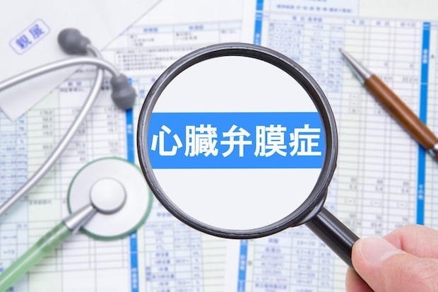 心臓弁膜症とはどんな病気？