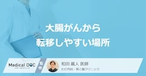 「大腸がんから転移しやすい場所」はご存知ですか？転移後の症状も医師が解説！