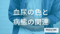 「血尿の色」で”出血部位”を見分けることができるのか？【医師監修】