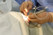 日帰り白内障手術に密着してみた Vol.1 カウンセリング編