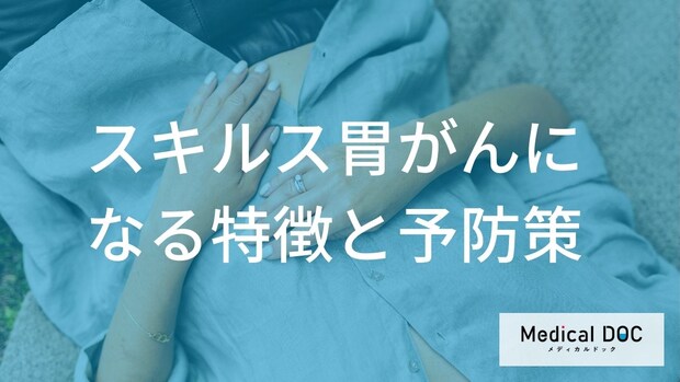 早期発見が難しい「スキルス胃がん」になりやすい人とは？日常でできる予防策【医師解説】