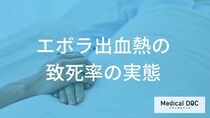 「エボラ出血熱」の『致死率』の実態をご存じですか？ “90%”って本当？【医師解説】