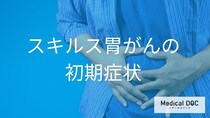 「スキルス胃がん」は自覚症状が少ない？日常の些細な変化から早期発見につなげるポイント【医師解説】