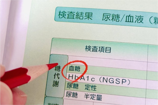 血糖値と糖尿病の関係