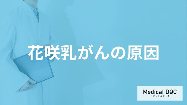 「花咲乳がんを発症する2つの原因」はご存知ですか?【医師監修】