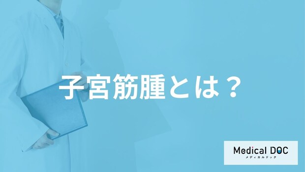 「子宮筋腫」はどんな病気？【医師監修】