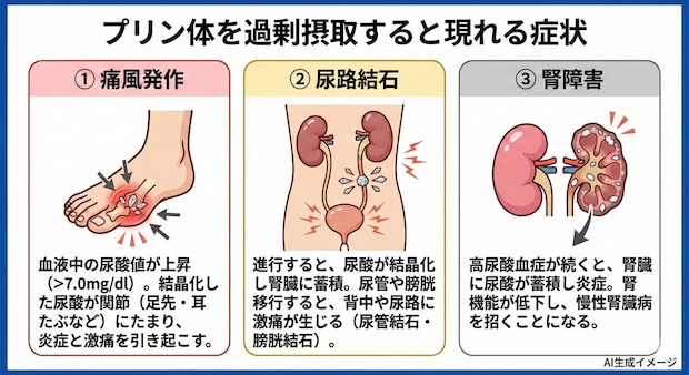 プリン体を過剰摂取すると現れる症状