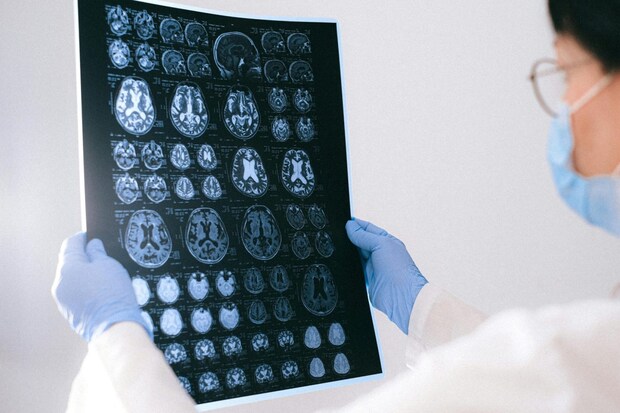 インフルエンザ脳症の検査と診断