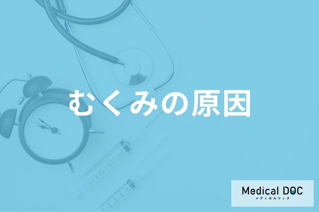 「むくみ」の原因はご存じですか? なぜ手足や体がむくんでしまうのか医師が解説!