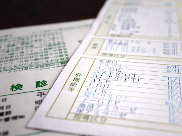 B型肝炎の基礎知識