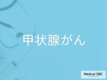 甲状腺がんの初期症状・セルフチェックのポイントをご存じですか？【医師監修】