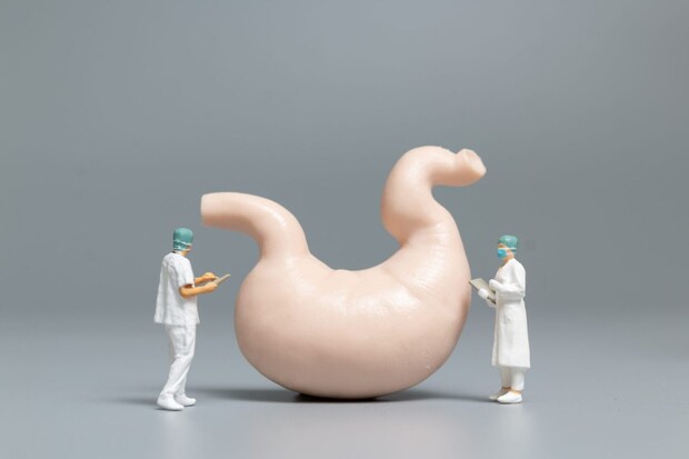 胃潰瘍で亡くなる確率