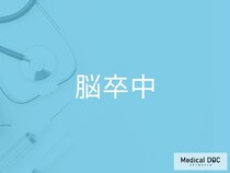 「脳卒中」の前兆を見逃していませんか？ 3つの重要サインを医師が解説
