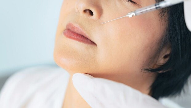 「くせじわ」「輪郭じわ」への『ヒアルロン酸注入』ってどのくらい効果が持続するの？【医師に聞く】