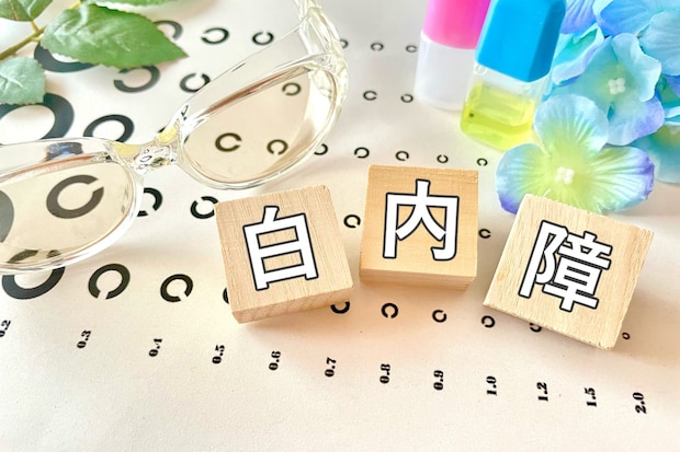 白内障ってどんな病気？