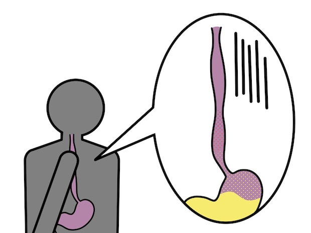 知っているようで知らない?! 食道の病気
