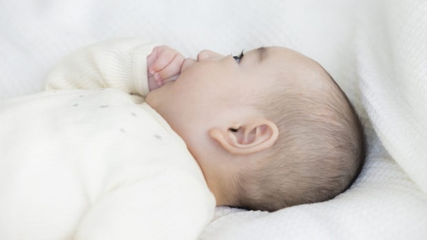 「赤ちゃんの頭のゆがみ」は治すことができる？ ヘルメット治療の適応・ベストな月齢を医師が解説