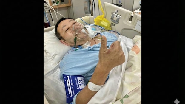 【闘病】人工肛門、1日20回のトイレ… 20年検診を避けた末の『直腸がん』ステージ3