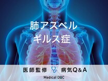 「肺アスペルギルス症」の症状や原因を解説！免疫機能が低下している人は要注意！
