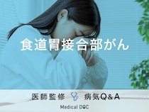 「食道胃接合部がん」の症状や原因はご存知ですか？ステージについても解説！