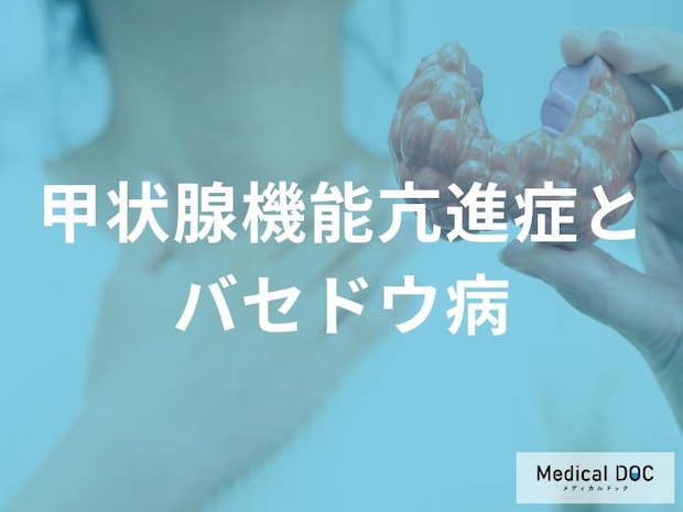 原因の80〜90％はバセドウ病？甲状腺ホルモンが過剰になる仕組みと3つの治療法
