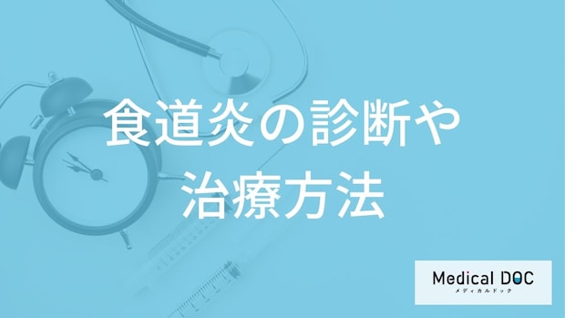 「食道炎」の症状には段階がある？胃カメラなどの検査や治し方も医師が解説！