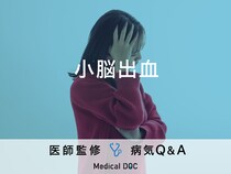 「小脳出血」の前兆となる症状・原因はご存知ですか？医師が監修！