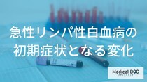 「急性リンパ性白血病」を早期に捉える。血液データと身体症状から紐解く病態の初期像