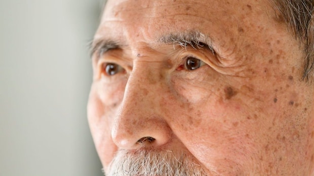 両眼の「白内障手術」は同日か別日か? メリット・デメリットを比較【医師解説】