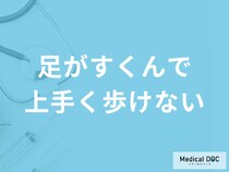 「足がすくんで上手く歩けなくなる」のは”何の初期症状”？他の原因も医師が解説！
