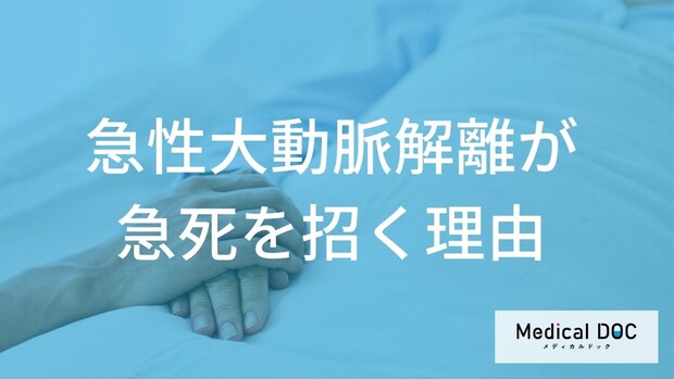 突然死を招く「急性大動脈解離」とは？医師が警告する発症メカニズムと2つの最大原因