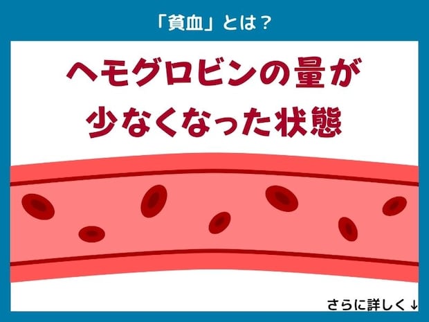 「貧血」とは？