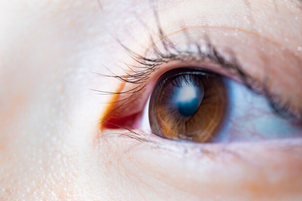 目の症状「甲状腺眼症」は元に戻るの？