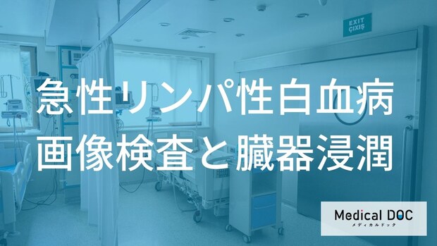 「急性リンパ性白血病」を正しく知る。画像検査で把握する全身への浸潤と治療計画の立て方