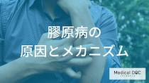 「膠原病」は初期だと診断が難しい？関節の痛みなど”疾患ごとの症状の違い”も医師が解説！