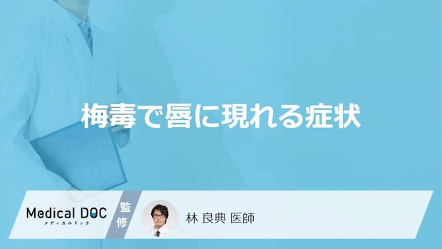 「梅毒」に感染すると「唇」にどんな症状が現れる？進行すると唇はどうなるかも解説！